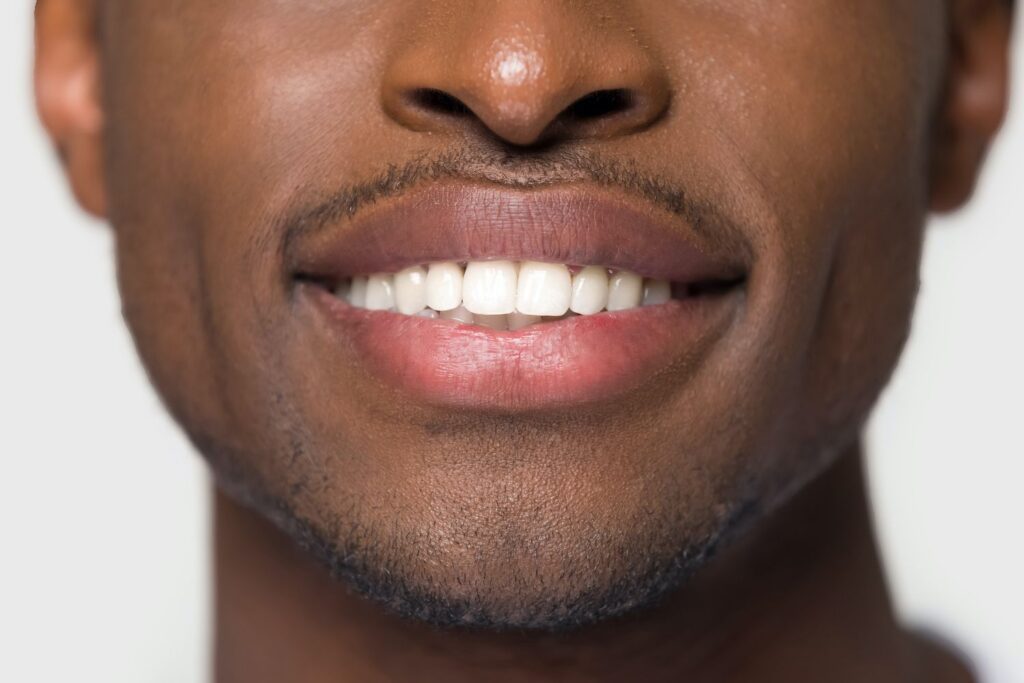 Choose Teeth Whitening from Your Dentist