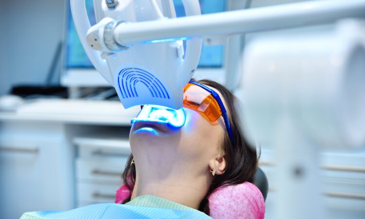 Over-the-counter treatments can't compare to the safety, precision, and long-lasting brightness of professional teeth whitening.